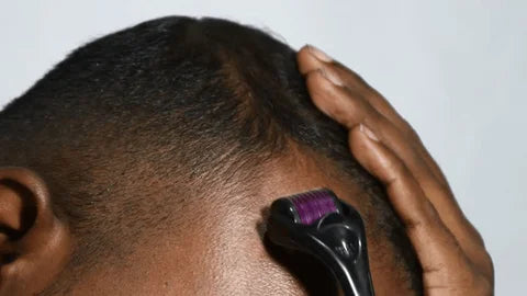 Derma Roller 1.5mm – Activate Your Hair Growth
