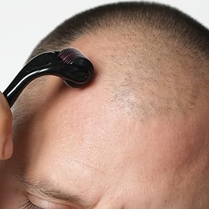 Derma Roller 1.5mm – Activate Your Hair Growth